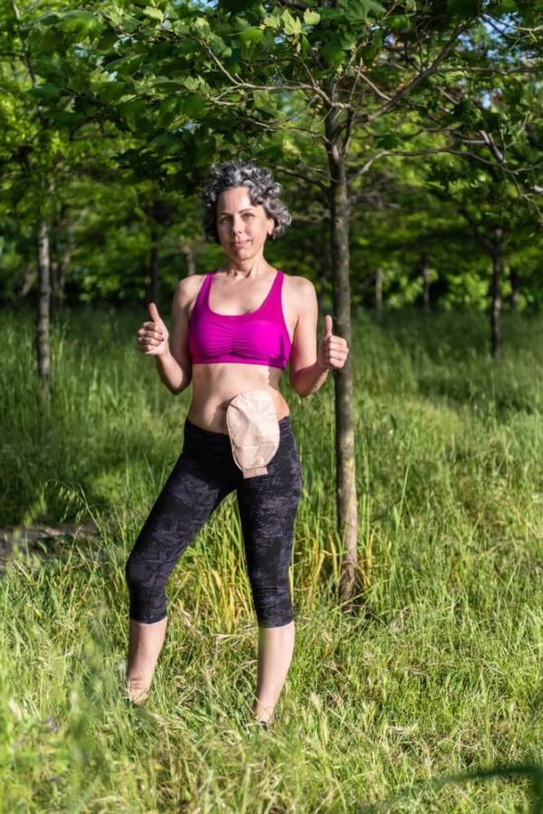 lady exercising outdoors with a colostomy bag