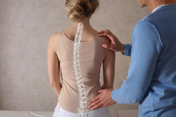 Assessing scoliosis | Complete Pilates