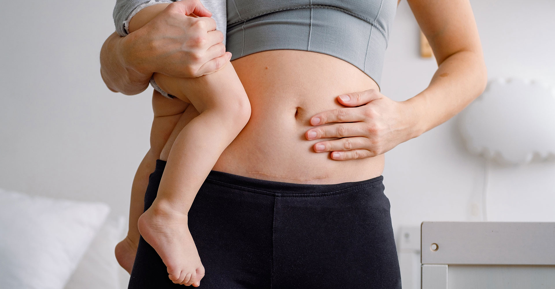 woman with c section scar holding baby Complete Pilates